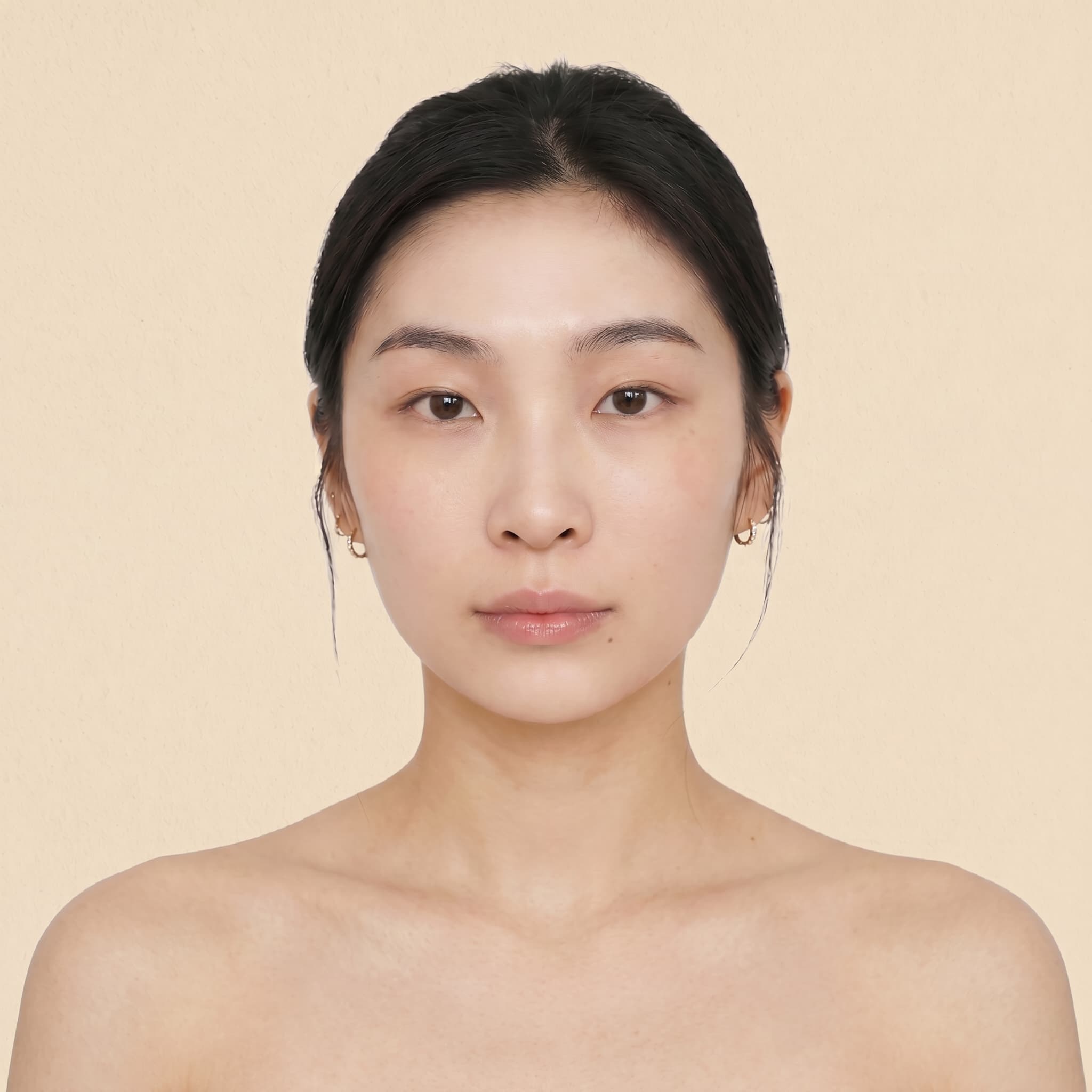 皮脂腺の選択的破壊