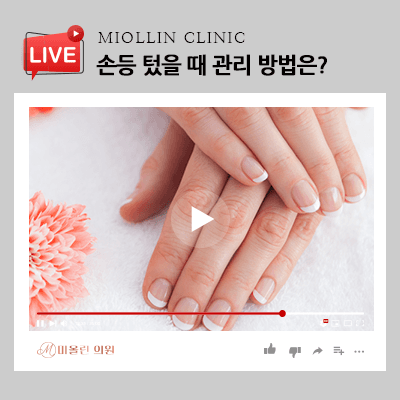 손등 텄을 때 관리방법, 촉촉한 손으로 거듭날 수 있는!