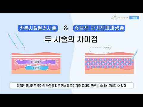Juvgen Video