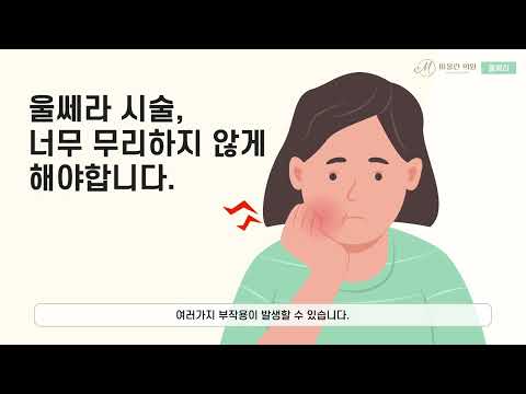 Ultherapy Lifting Video